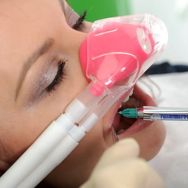 Sedación Consciente con Óxido Nitroso