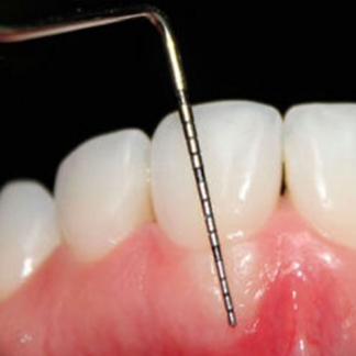 Diagnóstico Periodontal