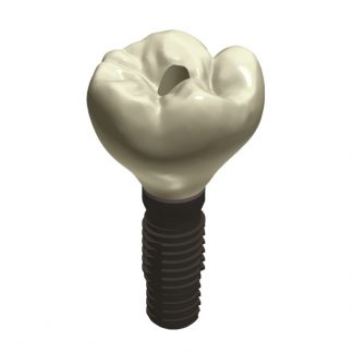 Corona de Zirconio / Implante Straumann