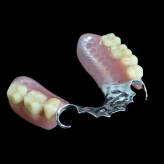 Prótesis Parcial Removible