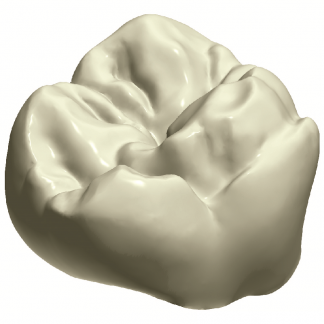 Corona Dental de Emax