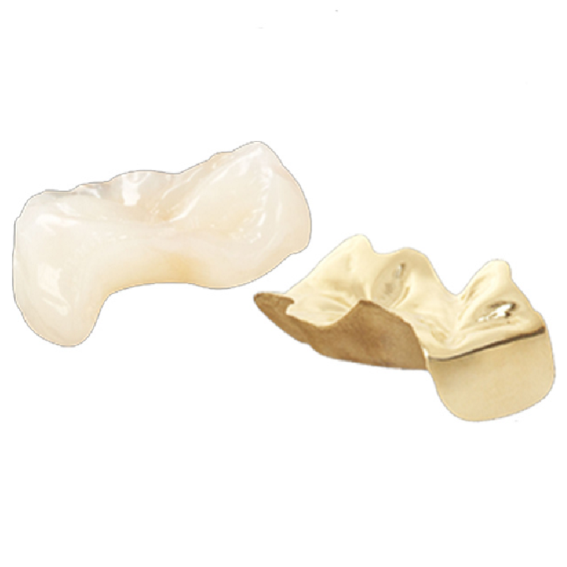 Dental Overlay GNUX Dental