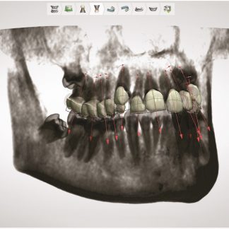 Estudio de Ortodoncia (Alineadores)