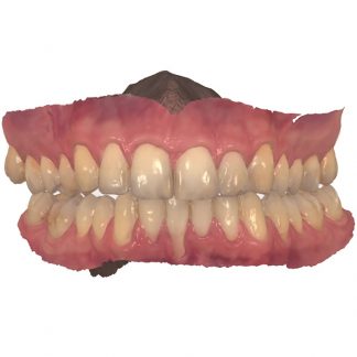 Intraoral Scanning