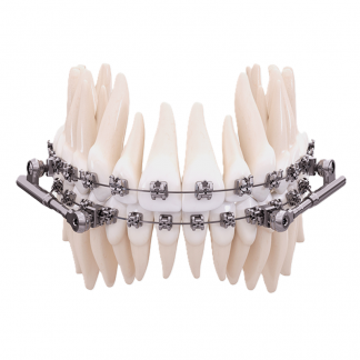 Corrector Clase II PowerScope AO